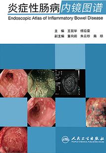 魂异界红眼装备加点